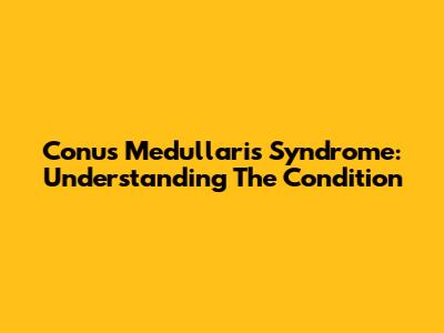 Conus Medullaris Syndrome: Understanding The Condition