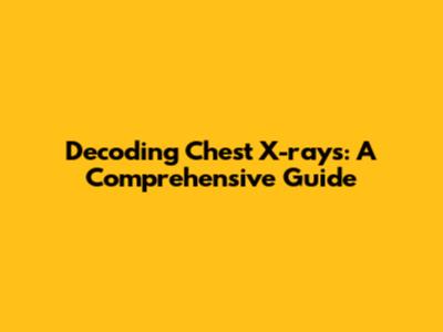 Decoding Chest X-rays: A Comprehensive Guide