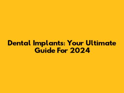 Dental Implants: Your Ultimate Guide For 2024