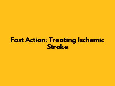 Fast Action: Treating Ischemic Stroke