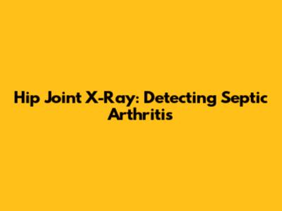 Hip Joint X-Ray: Detecting Septic Arthritis