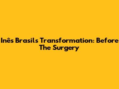 Inês Brasil's Transformation: Before The Surgery