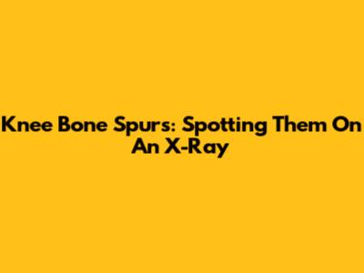 Knee Bone Spurs: Spotting Them On An X-Ray