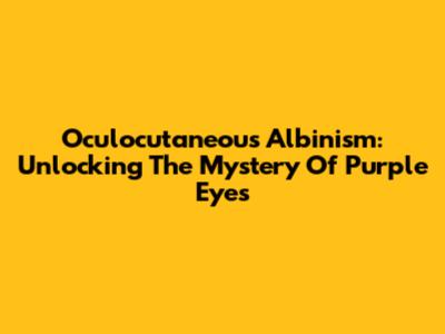 Oculocutaneous Albinism: Unlocking The Mystery Of Purple Eyes