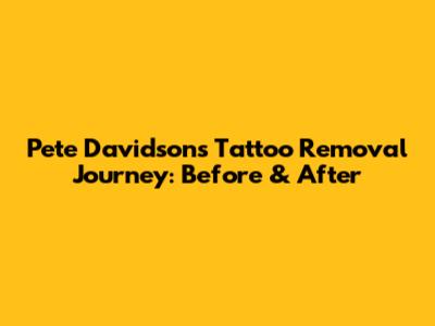 Pete Davidson's Tattoo Removal Journey: Before & After