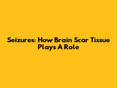 Seizures: How Brain Scar Tissue Plays A Role